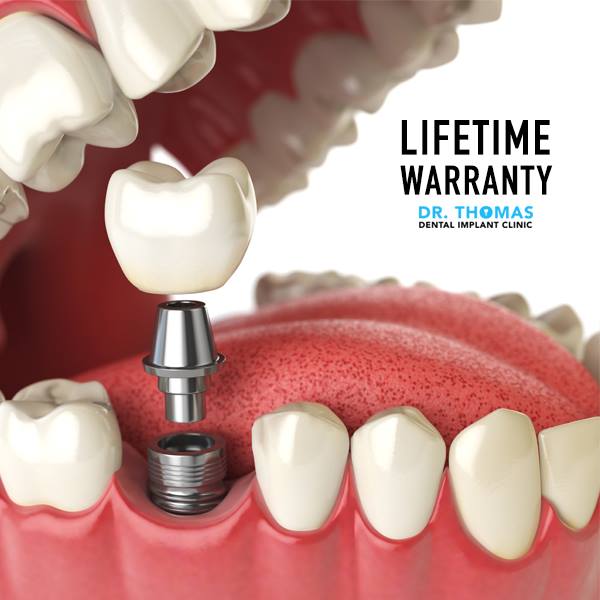 Dr. Thomas Dental Implant Clinic, Dubai