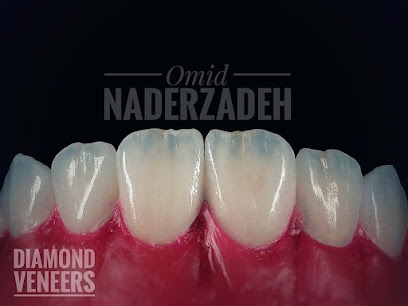 Diamond veneers