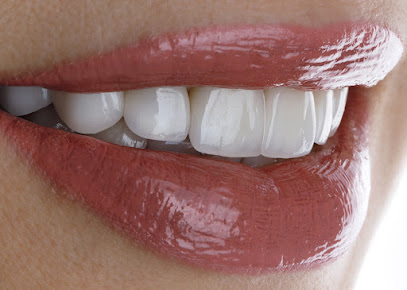 Veneers Dubai - Hollywood Smile