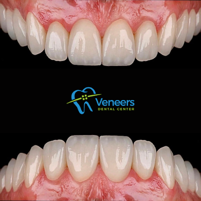 Veneers Dental Center
